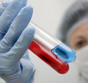 В Волгограде более 10 000  больных ВИЧ