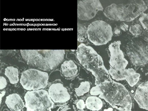 Фото камня под микроскопом