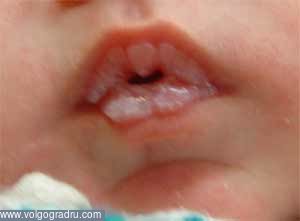 Внешние признаки болезней: белые губы