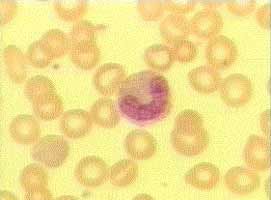 Так выглядит мазок крови под микроскопом