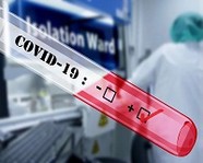 В России от коронавируса умерли первые пациенты